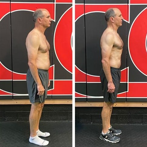 How Matthew Kicked Back Pain to the Curb Despite Long Hours Performing Surgery: a Case Study